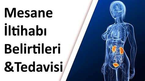 Sistit Nedir: Mesane İltihabı ve Belirtileri