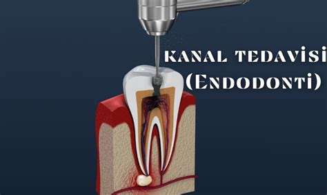 Endodonti Nedir: Diş Kökü Tedavisi Alanı