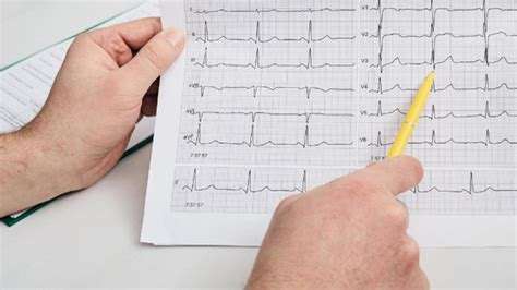 EKG Nasıl Çekilir: Elektrokardiyografi İnceleme Prosedürleri