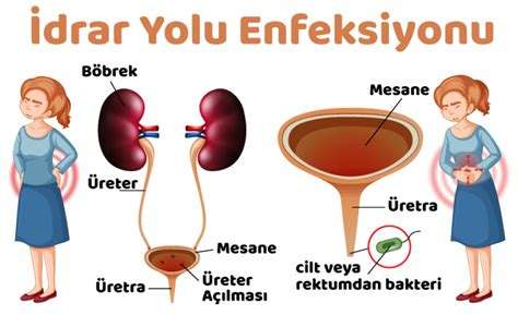 İdrar yolu enfeksiyonuna ne iyi gelir?