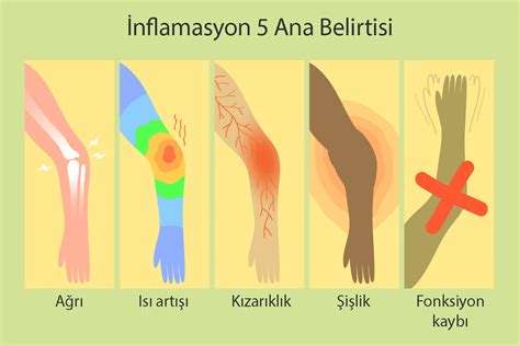 İnflamasyon Nedir: Vücutta İltihap Oluşumunun Anlamı