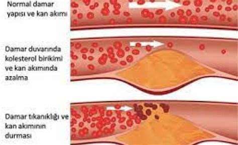 Trigliserid Nedir: Kan Yağlarının Önemi ve Kontrolü